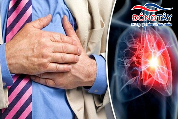 Chụp mạch vành thường được áp dụng chẩn đoán và điều trị ở người bệnh mạch vành hoặc bị các bệnh tim mạch khác